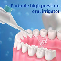 Household High Pressure Oral Teeth Cleaner